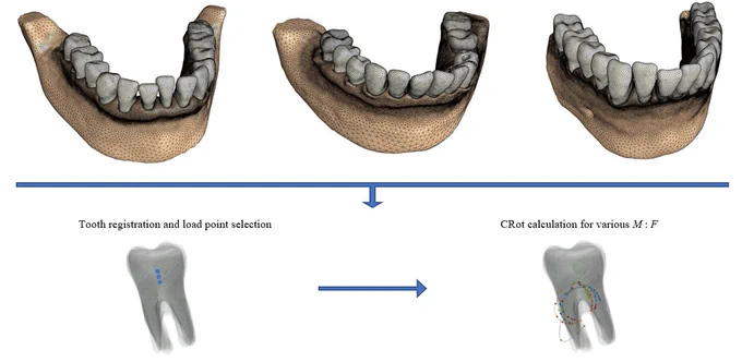 We performed an inter- and intra-patient analysis on different tooth movement types.