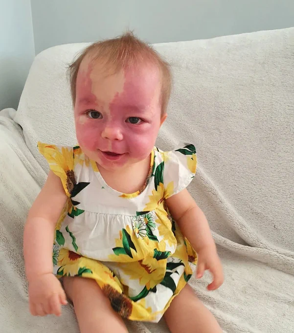 Lily is wearing a white and yellow summer dress and smiles at the camera.