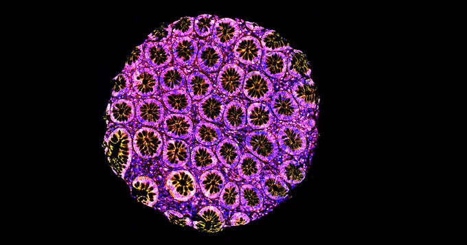 Art of Research Photo: Immunofluorescence Stain by Shakeel Virk and Lee Boudreau, CCTG Tissue Bank