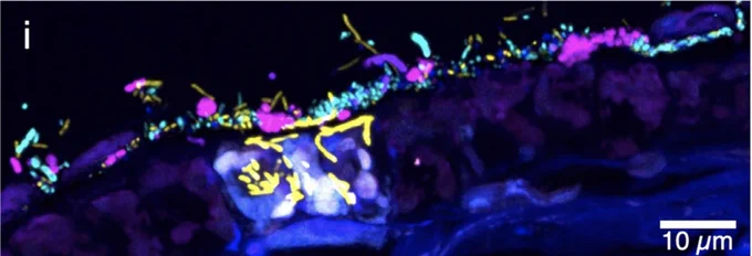 This image of kelp blade shows microbial biofilm on both sides of the blade.

