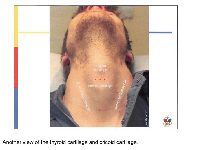 image credit: from https://www.nh.gov/safety/divisions/fstems/ems/advlifesup/documents/cricoadministration.pdf