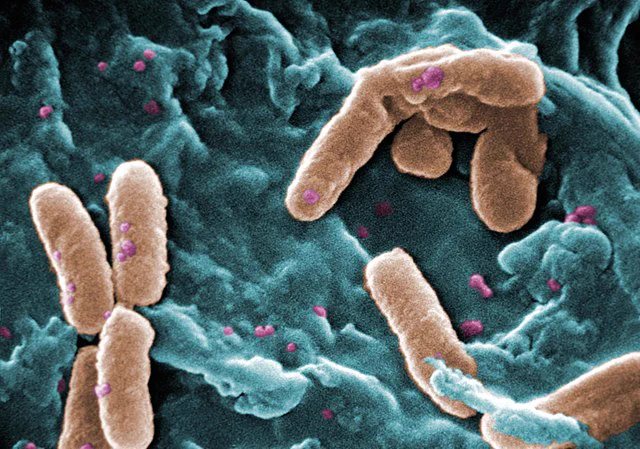 scanning electron microscope image of bacteria 
