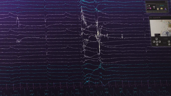 A graph showing pulsing lines up and down. 