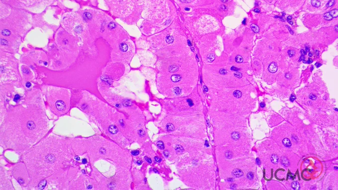 400X magnification