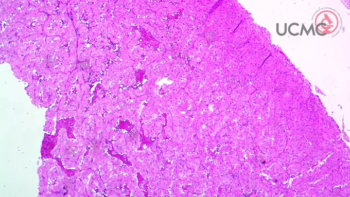 40X magnification