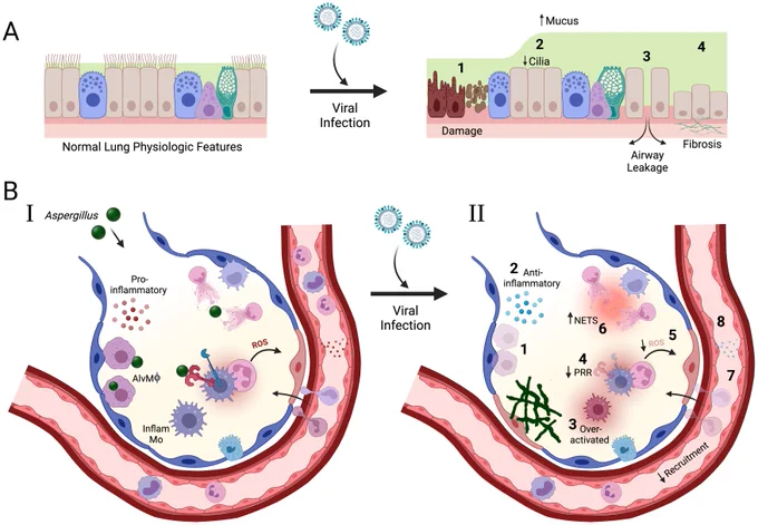 Fig 1. Graphic of the major physiologic and immunologic consequences from viral infection found to be involved in secondary bacterial susceptibility described in [4].
Created with BioRender.com. Read the full caption: https://journals.plos.org/plospathogens/article?id=10.1371/journal.ppat.1011334