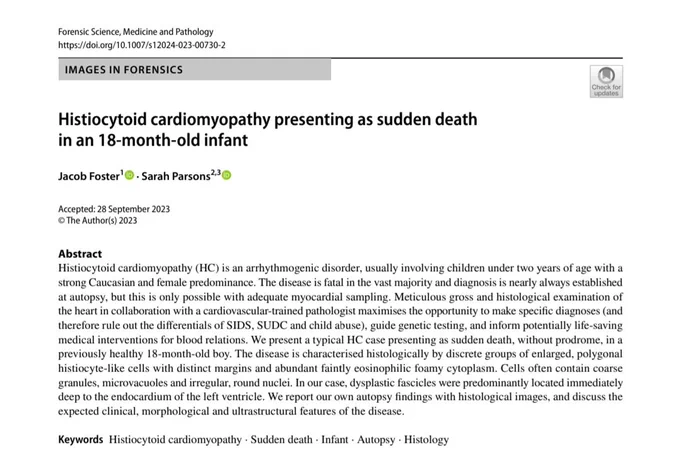 A PDF excerpt of an open access 'Images in Forensics' article published in 2023 in Forensic Science Medicine and Pathology entitled 'Histiocytoid cardiomyopathy presenting as sudden death in an 18-month-old infant' by Jacob Foster and Sarah Parsons. The excerpt also shows the abstract and keywords. 