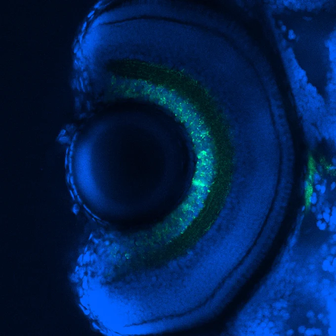Image the head (specifically the eye) of a 5 day old zebrafish larva stained with blue and green