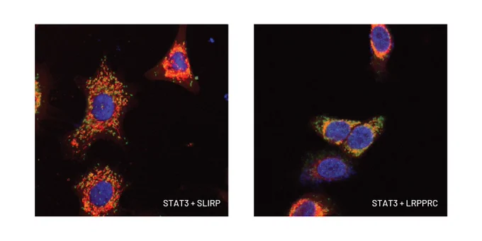 Cell image shows the interaction between proteins (green) in the mitochondria (red). The top image is the interaction between STAT3 and SLIRP, bottom is STAT3 and LRPPRC. The blue dye shows the cell nucleus.