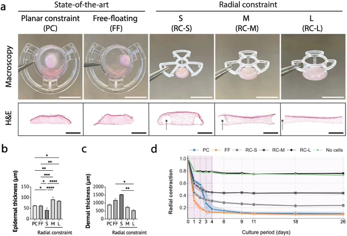 Macroscopic analysis of HSEs shows an effect of radial constraint.

a) Representative macroscopic images (upper panel) and hematoxylin & eosin (H&E)-stained cross-sections (lower panel) of HSEs from all experimental groups after 26 days of culture: Planar constraint (PC), free-floating (FF), radial constraint S (RC-S), radial constraint M (RC-M) and radial constraint L (RC-L). The depicted arrow points to the location of the 3D-printed culture insert. Scale bars; 10 mm for macroscopic images and 2 mm for H&E cross-sections.

b) Epidermal thickness of the produced HSEs after 26 days of culture was measured in H&E-stained sections. *P < 0.05, **P < 0.01, ***P < 0.001, ****P < 0.0001.

c) Dermal thickness of the produced HSEs after 26 days of culture was measured in H&E-stained sections. *P < 0.05 and **P < 0.01 (Kruskal-Wallis test with Dunn's multiple comparison test).

d) Radial area contraction of HSEs over the total culture period (26 days).

Graphs show mean ± standard deviation.
