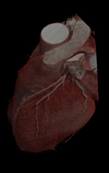 Photorealistic render of a Cardiac CT scan.