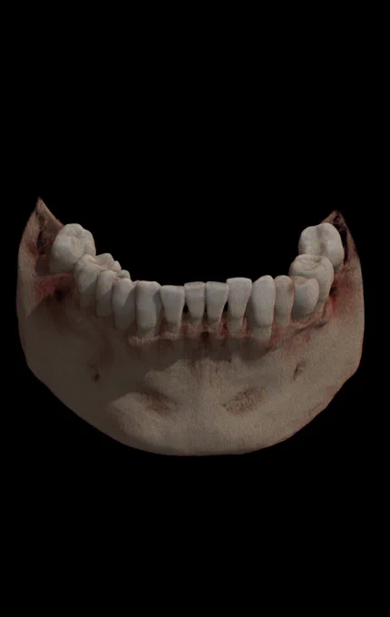 Photorealistic rendering of a CBCT demonstrating the anatomy of the teeth.