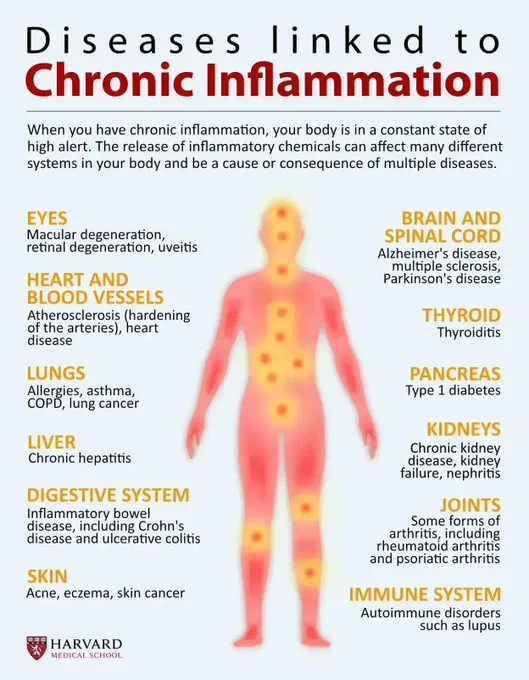 An infographic of disease linked to chronic inflammation that affect different parts of the body.