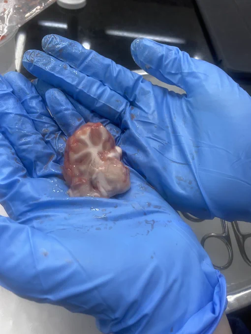 Brain dissection 🧠
