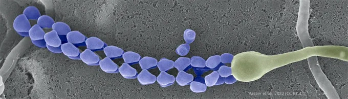 Scanning electron microscopy image of streptococcus and a chain of spores