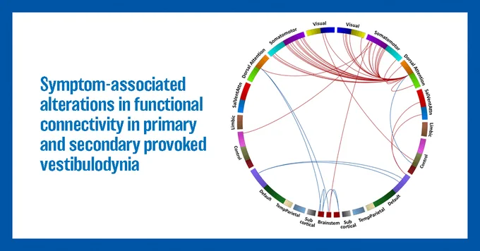 Women with secondary PVD had increased dorsal attention-somatomotor network connectivity (red) compared to women with primary PVD who predominantly show greater intrinsic connectivity within the brainstem and the default mode network (blue). 