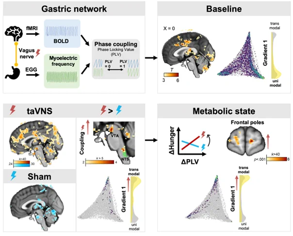 Using a single-blind randomized crossover design, we investigated the effect of acute right-sided transcutaneous auricular vagus nerve stimulation (taVNS) versus sham stimulation on stomach-brain coupling. In line with preclinical research, taVNS increased stomach-brain coupling in the nucleus of the solitary tract (NTS) and the midbrain while boosting coupling across the brain. Crucially, in the cortex, taVNS-induced changes in coupling occurred primarily in transmodal regions and were associated with changes in hunger ratings as indicators of the subjective metabolic state. 