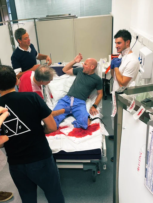 Simulation of bilateral below knee amputation.