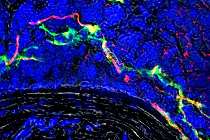 Nerve network (red) in diseased artery adventitia.
@LMU
