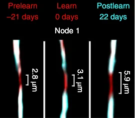 Learning induces myelin and nodal dynamics