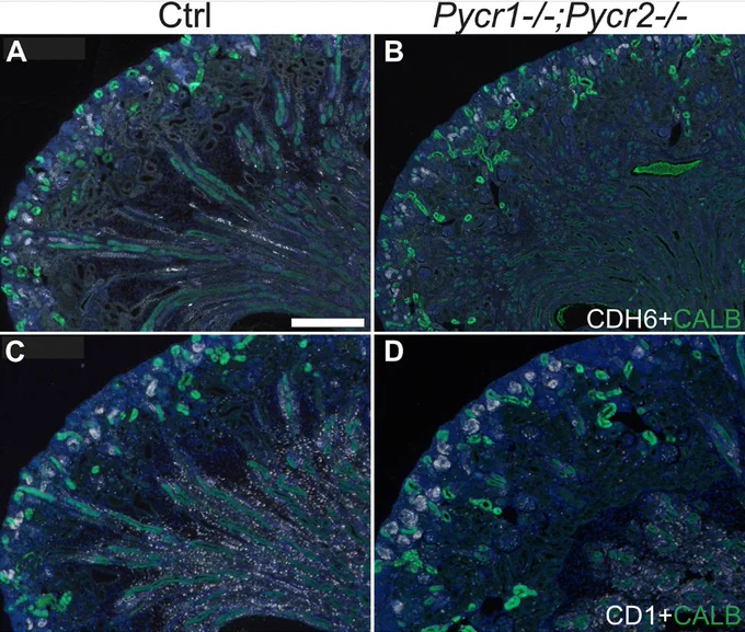 Control and Pycr1/2 double-knockout kidneys immunostained with cadherin 6 (CDH6, white), and calbindin (CALB, green).