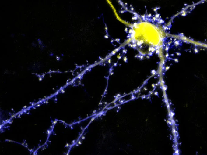 The postsynaptic scaffold protein AKAP79 (tagged with CFP, blue) and the protein phosphatase Calcineurin A subunit (tagged with YFP, yellow) in a hippocampal neuron