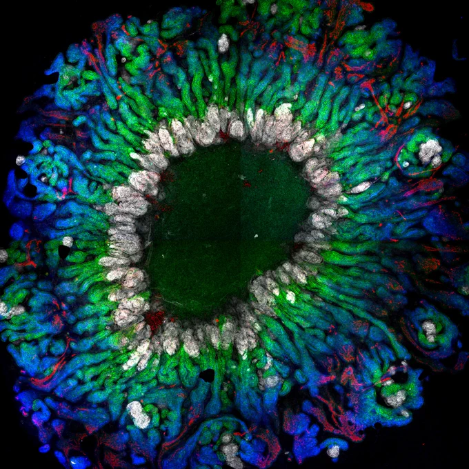 Confocal immunofluorescence image of a proximal tubule-enhanced organoid showing proximalised and aligned nephrons radiating outwards (podocytes; grey, proximal tubules; blue, loop of Henle; red, nephron epithelium; green). 