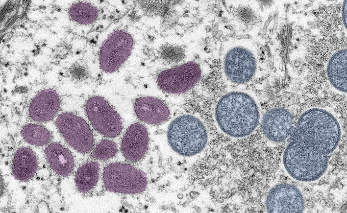 Photo courtesy of the CDC