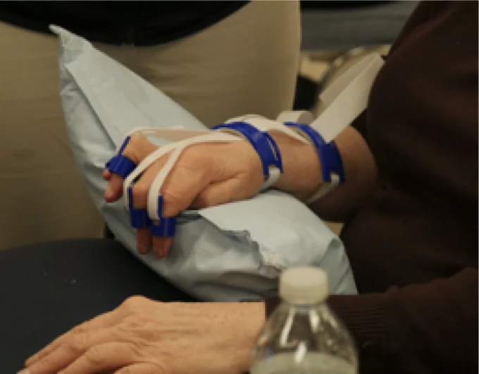 A user wearing a 3D printed assistive device connected to their fingers with velcro straps