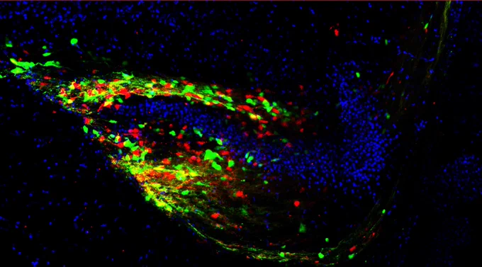 Image showing autism-associated Neuroligin-3 R451C mutant and control human-induced neurons transplanted in mouse brain. 