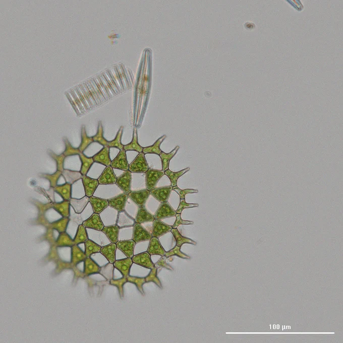 Yvette Morales got a BEAUTIFUL micrograph of a Pediastum algae from a pond sample!