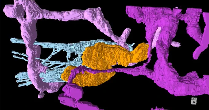 A 3d reconstruction of a desmosome, keratin filaments, and the endoplasmic reticulum from a FIB-SEM dataset.