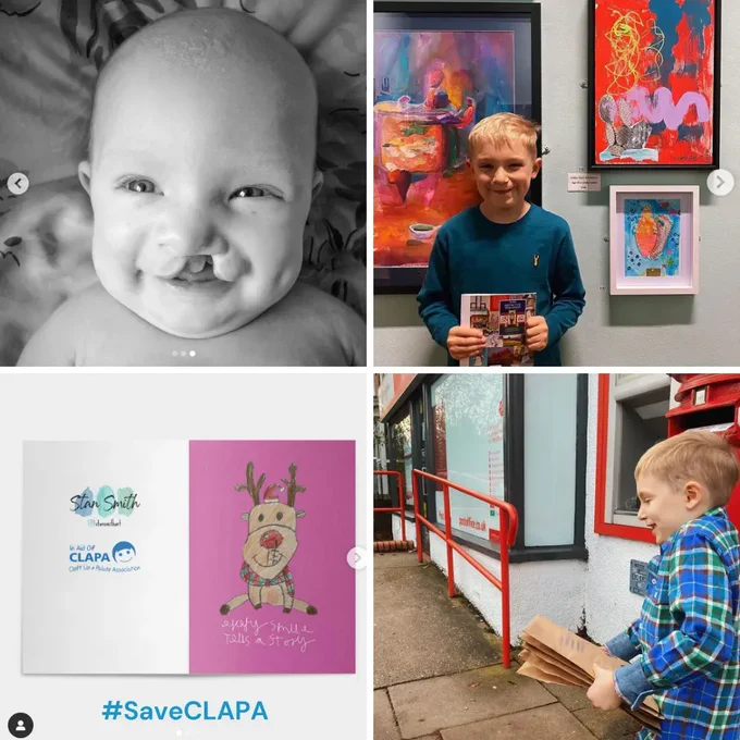 [Image ID: A collage of four photos. The top left is a photo of a baby smiling, the top right is Stanley at his exhibition, the bottom right is Stanley's reindeer Christmas card, and the bottom left is Stanley posting his cards.] 