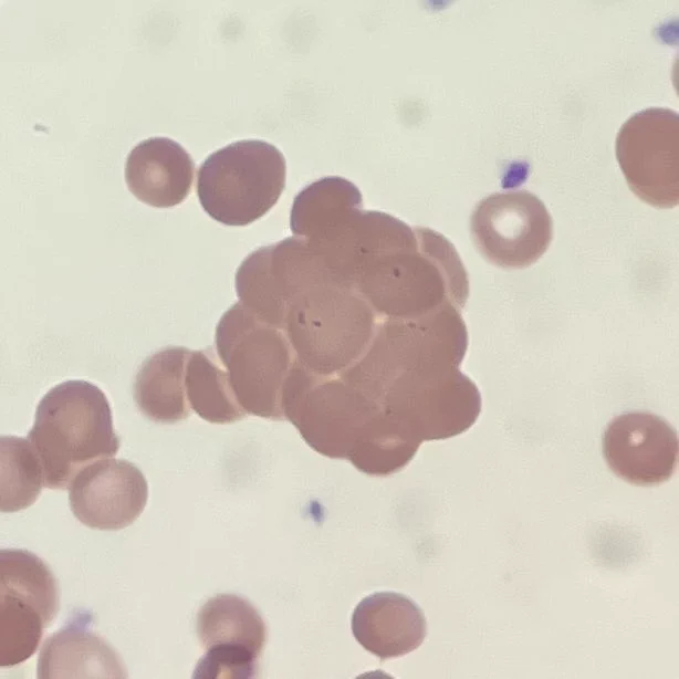 Red blood cell agglutination