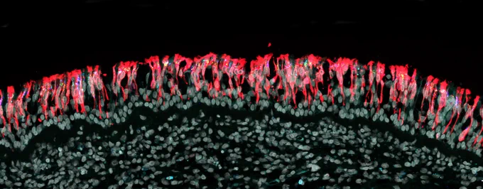 Anatomical barriers shield the brain from SARS-CoV-2 invasion at vulnerable interfaces. Credit: M. Khan