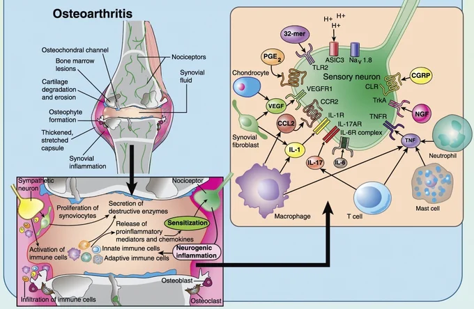 Disease mediators in osteoarthritis. Image from https://journals.lww.com/pain/Fulltext/2021/03000/Cell_cell_interactions_in_joint_pain__rheumatoid.7.aspx 