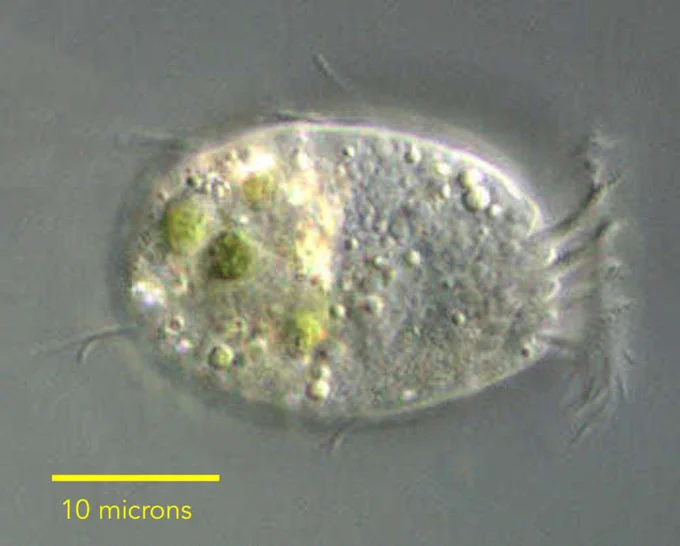 Image of Halteria, a microscopic protist that eats viruses as a food source.