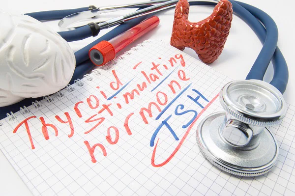 words Thyroid Stimulating Hormone text. thyroid brain and stethoscope models