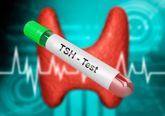 test tube says TSH text, thyroid gland image in background