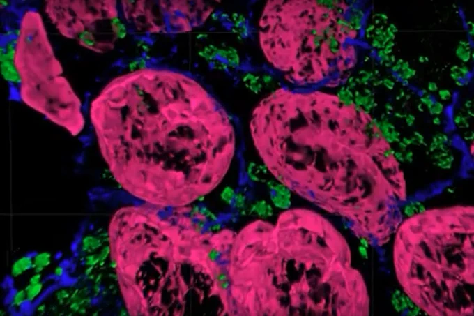 Magnified cells.