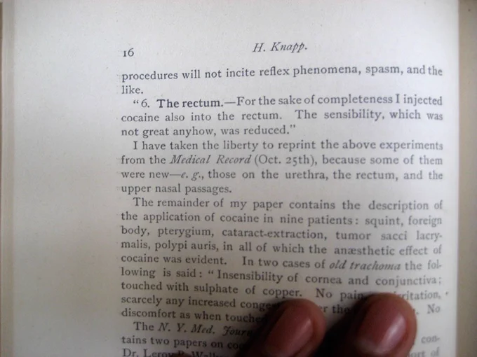 Photo of a book, “Cocaine and its use in ophthalmic and general surgery” by H. Knapp, Professor of Ophthalmology at the University of the City of New York; G.P. Putnam's Sons, 1885. 

Two fingertips are at the bottom of the photo, holding the page.

page reads: 

16  H.Knapp.

“6. The rectum. - for the sake of completeness I injected cocaine also into the rectum. The sensibility, which was not great anyhow, was reduced.
 I have taken the liberty to reprint the above experiments from the Medical Record (Oct. 25th), because some of them were new -e.g., those on the urethra, the rectum, and the upper nasal passages.
 The remainder of my paper contains the description of the application of cocaine in nine patients: squint, foreign body, pterygium, cataract-extraction, tumor sacci lacrymalis…“ etc.