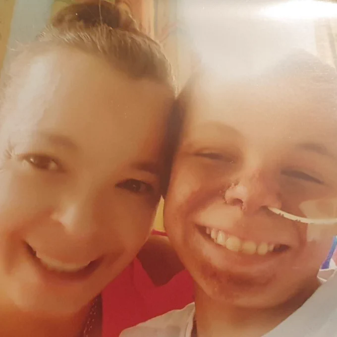 Marcus and his mum smile at the camera, he has a tube coming out from his nose.