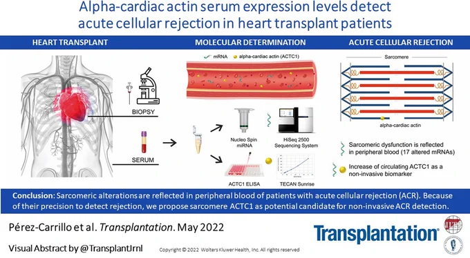 Visual Abstract for the article entitled Alpha-cardiac Actin Serum Expression Levels Detect Acute Cellular Rejection in Heart Transplant Patients