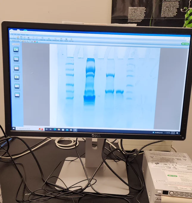 Completed gel.  Will analyze. Who is positive or negative or ambiguous?