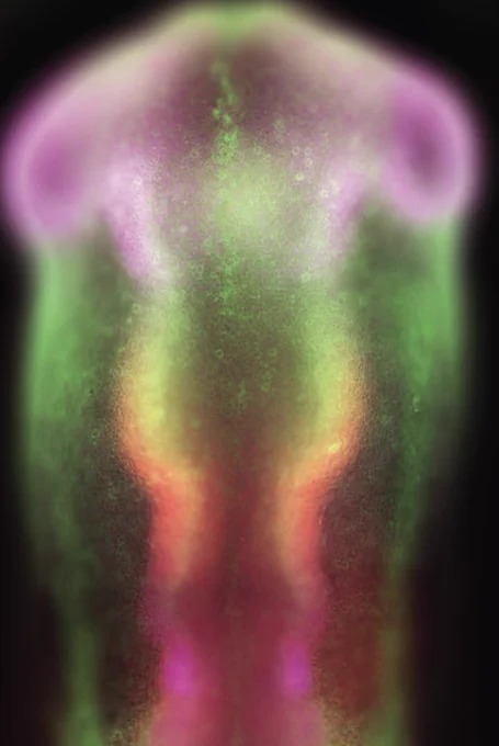 Fluorescent image of quail embryo showing expression of Ecad (green), pax6 (pink) and pax2 (orange)