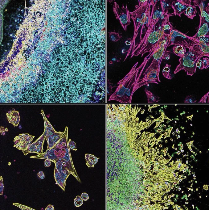 Neural crest cells in culture