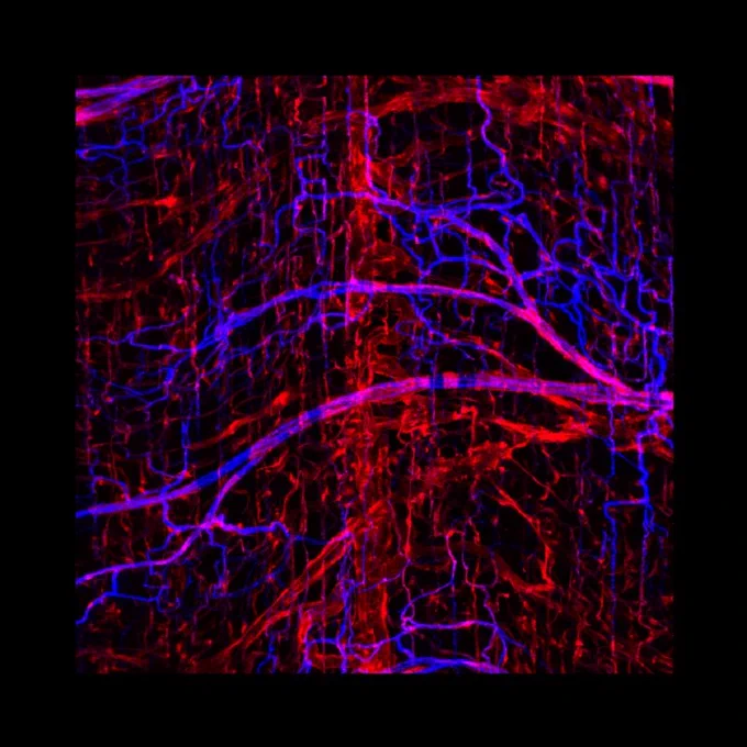 Fluorescent labeling of endothelial and mural cells in blood vessels within muscle tissue allows for quantification of vascular remodeling occurring in response to induced blood flow changes. This technique helps us to better understand the body's response to vascular diseases. In this example, the vascular mural cell marker used is also present on cells in nerves. Submitted by Anthony Bruce.