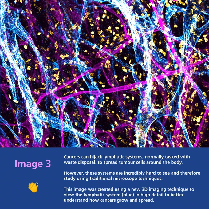  Image 3 show a vibrant black, pink, white and yellow structure. It was created using a new 3D imaging technique to view the lymphatic system (blue) in high detail to better understand how cancers grow and spread.

Cancers can hijack lymphatic systems, normally tasked with waste disposal, to spread tumour cells around the body. However, these systems are incredibly hard to see and therefore study using traditional microscope techniques.