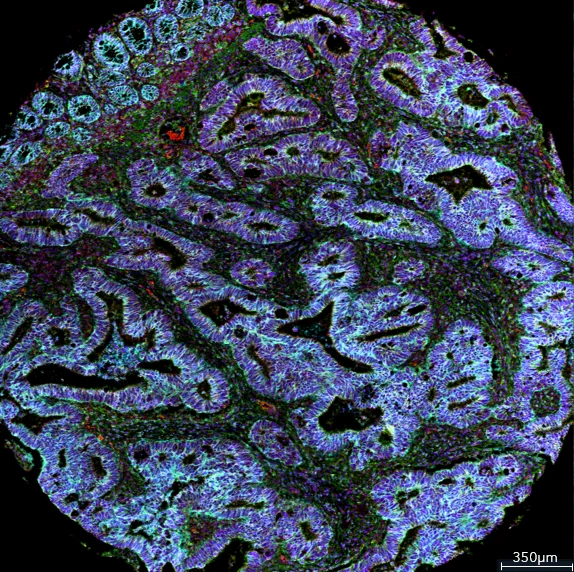 Standard BioTools Imaging Mass Cytometry with the IMC Cell Segmentation Kit and Visiopharm Phenoplex software