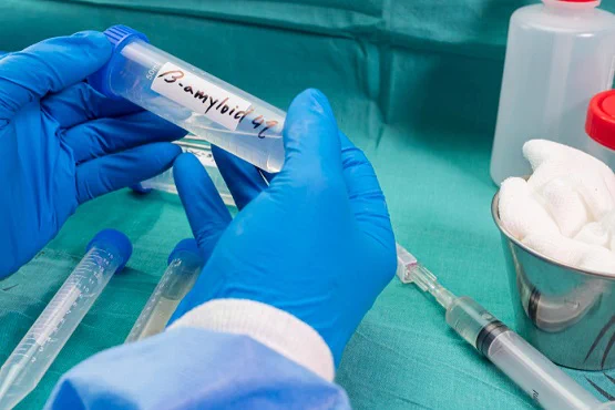 A pair of hands wearing blue latex gloves holds a test tube.